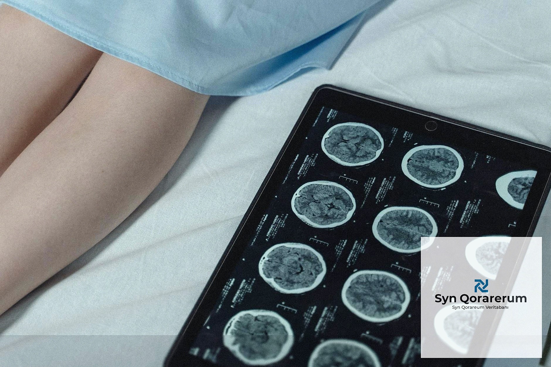 Bulut Tabanlı Veritabanları: Hız, Ölçek ve Güvenlikte Yeni Boyutlar - section 6